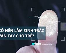 Có Nên Làm Sinh Trắc Vân Tay Không